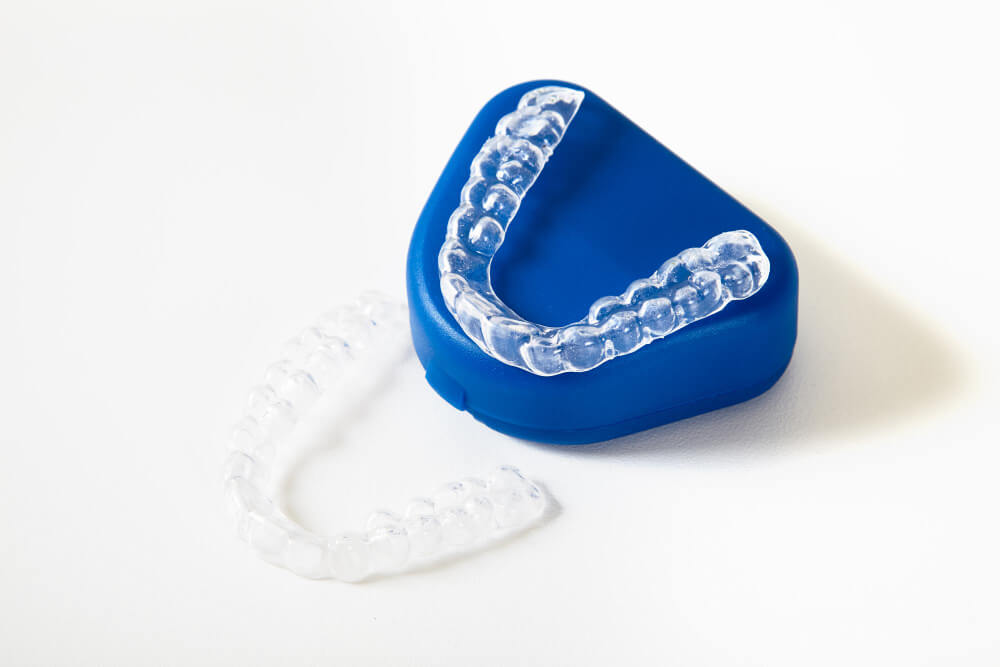 invisalign | dr ryan kaltio dental clinic